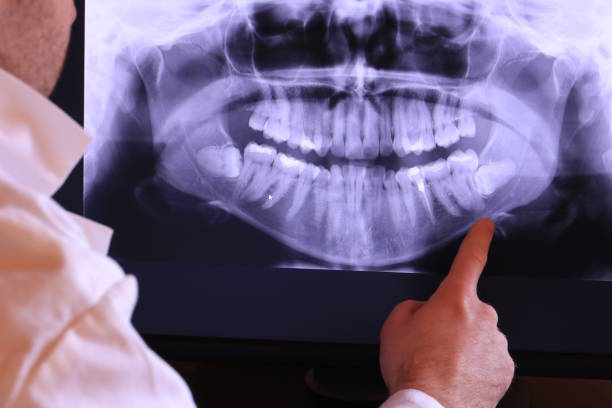 Best Urgent Care for Lost Fillings or Crowns in Sheridan, AR