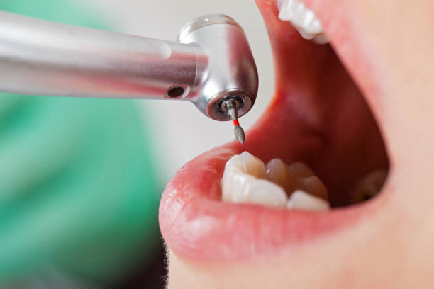 Best Emergency Gum Treatment in Sheridan, AR